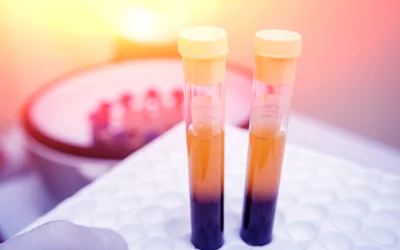 PRP: What is it and Why You Should Incorporate it Into Your Treatment